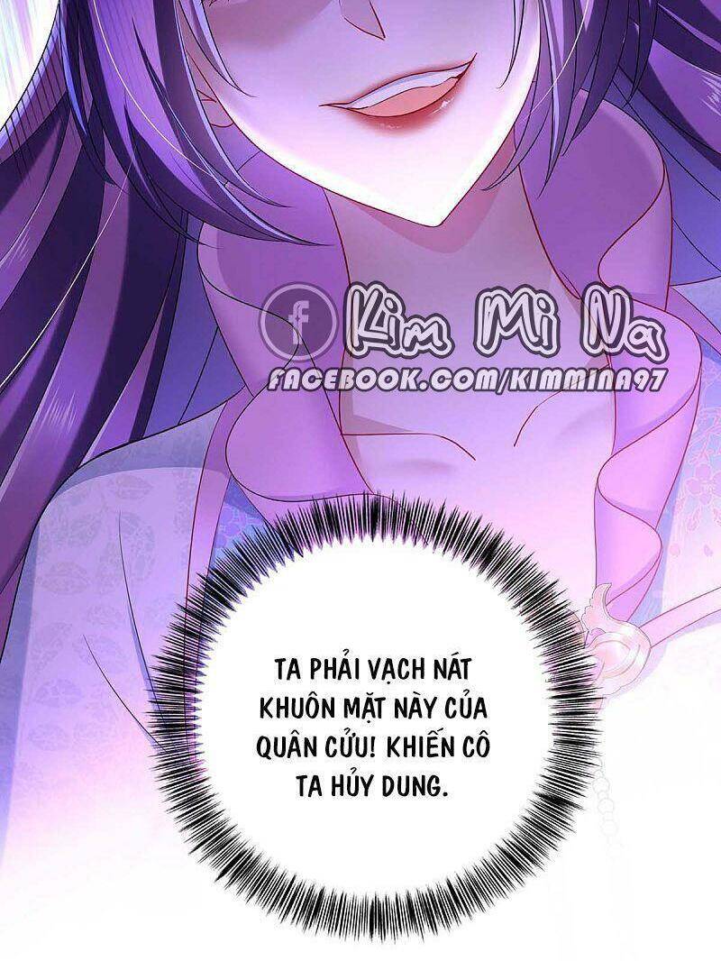 ta ở dị giới nuôi dưỡng nam thần: thần y cửu tiểu thư Chapter 92 - Next Chapter 93